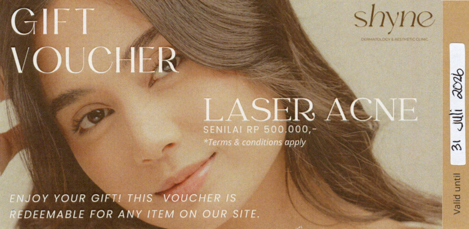 Laser Acne - #05